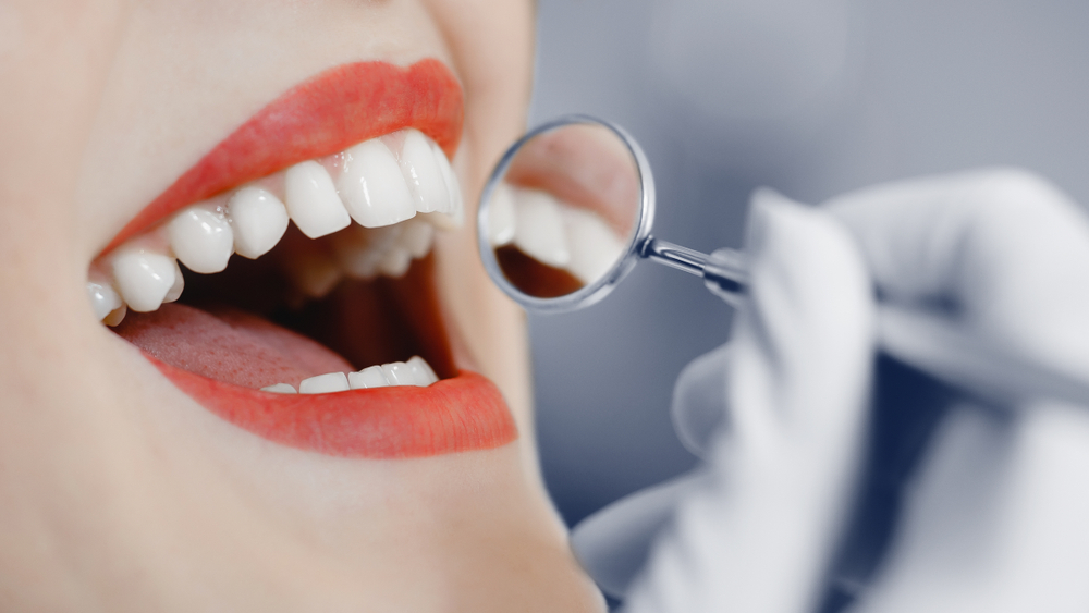 An image displaying a dental exam