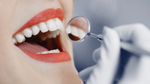 Photo showing benefits of a professional dental cleaning